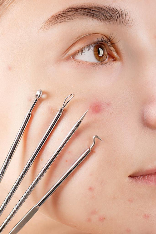 Blackhead Extractor Tools Kit